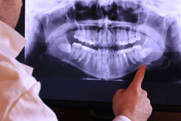Best Pediatric Emergency Dentist in Linln Park, CO