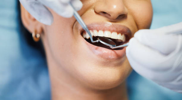 Best Emergency Tooth Extraction in Linln Park, CO